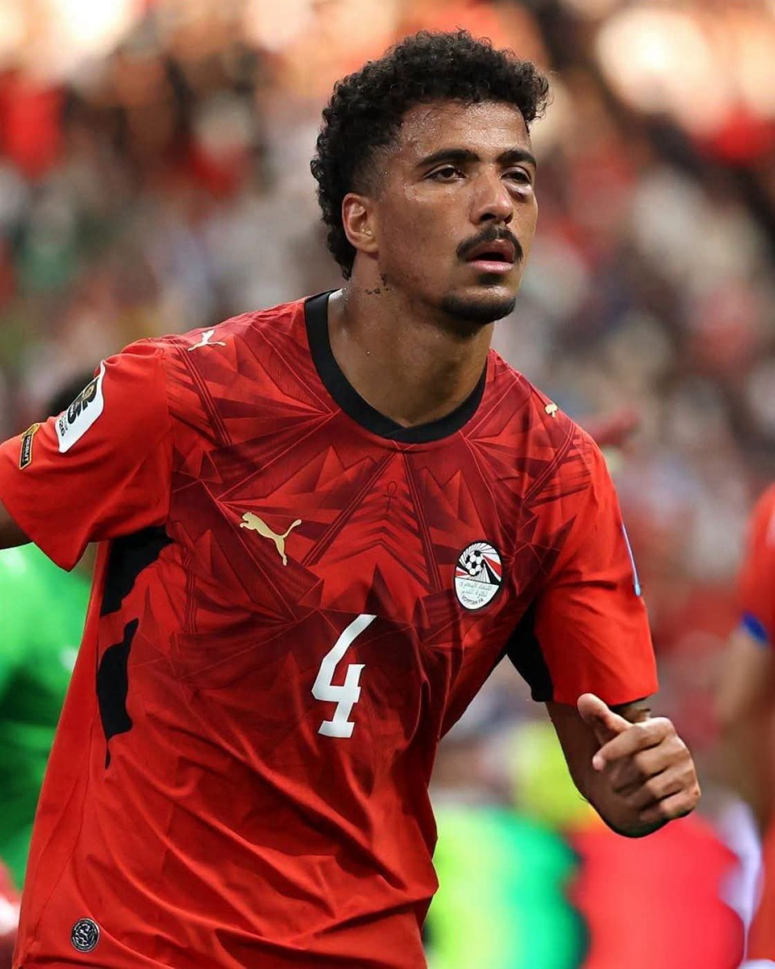 إصابة حسام عبدالمجيد&nbsp;