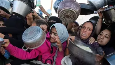آلاف الأطفال في غزة يعانون سوء التغذية الحاد