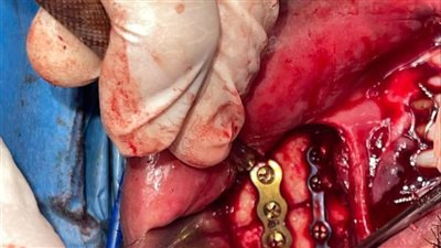طب دمياط ينجح في إجراء عمليات الجراحات الدقيقة 