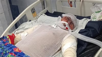 معاناة لا تنتهي.. أزمة في نقل ضحية حريق شبرا الخيمة إلى مستشفى أهل مصر