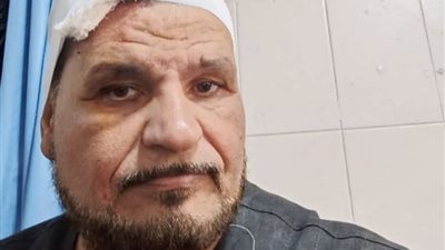 سيارة مجهولة الهوية تصدم المرشح الانتخابي زين دبور لمجلس النواب بالمنوفية