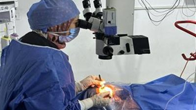 جراحة تجميلية دقيقة بمستشفى رمد المنصورة لإصلاح تهتك شديد بجفن العين