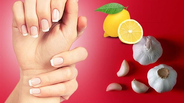 طلاء الأظافر بالثوم
