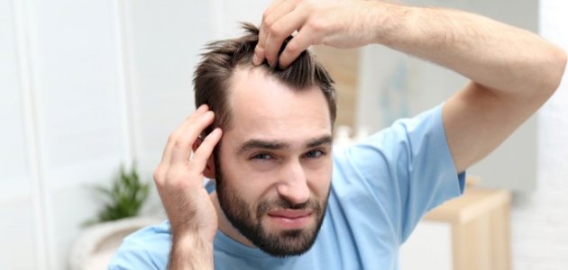 تعرق فروة الرأس