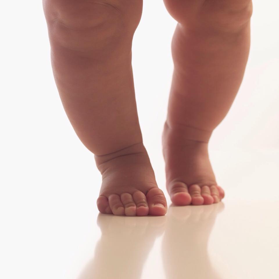 تقوس الرجل عند الأطفال