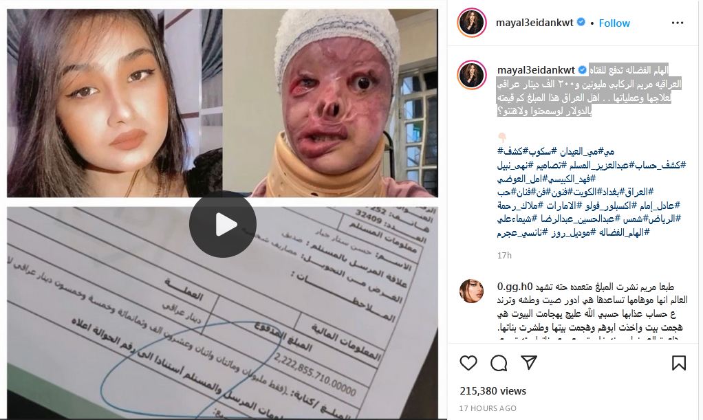 مي العيدان تكشف قيمة المبلغ الذي تبرعت به الهام الفضالة للعراقية مريم الركابي