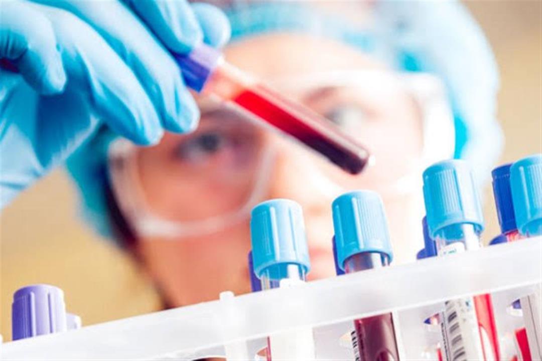 اختبار دم يكشف السرطان
