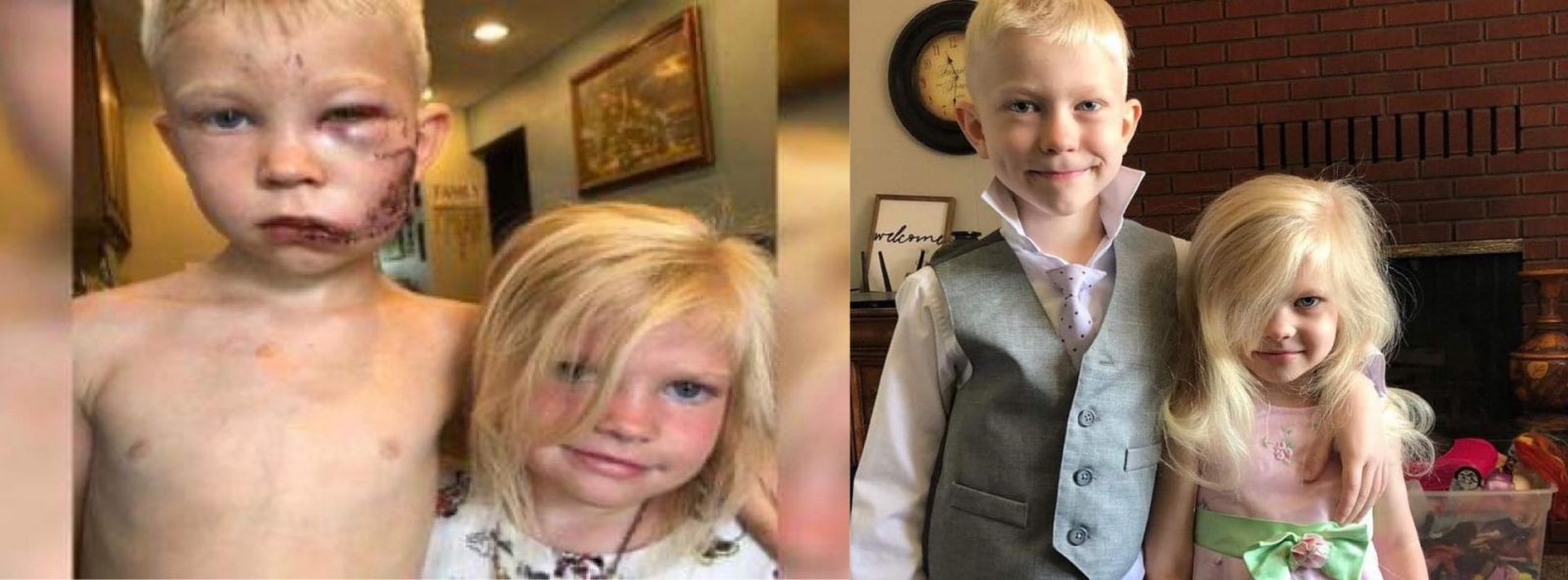 سبايدر مان يستضيف الطفل الذي أنقذ شقيقتة من هجوم الكلب