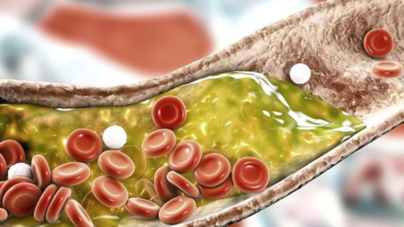 حقنة اسكات الجينات تخفض الكولسترول في الدم