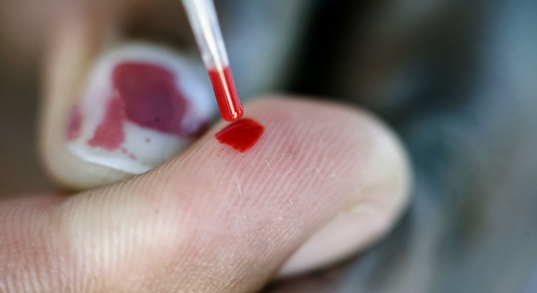 فوائد العسل الأسود للوقاية من فقر الدم