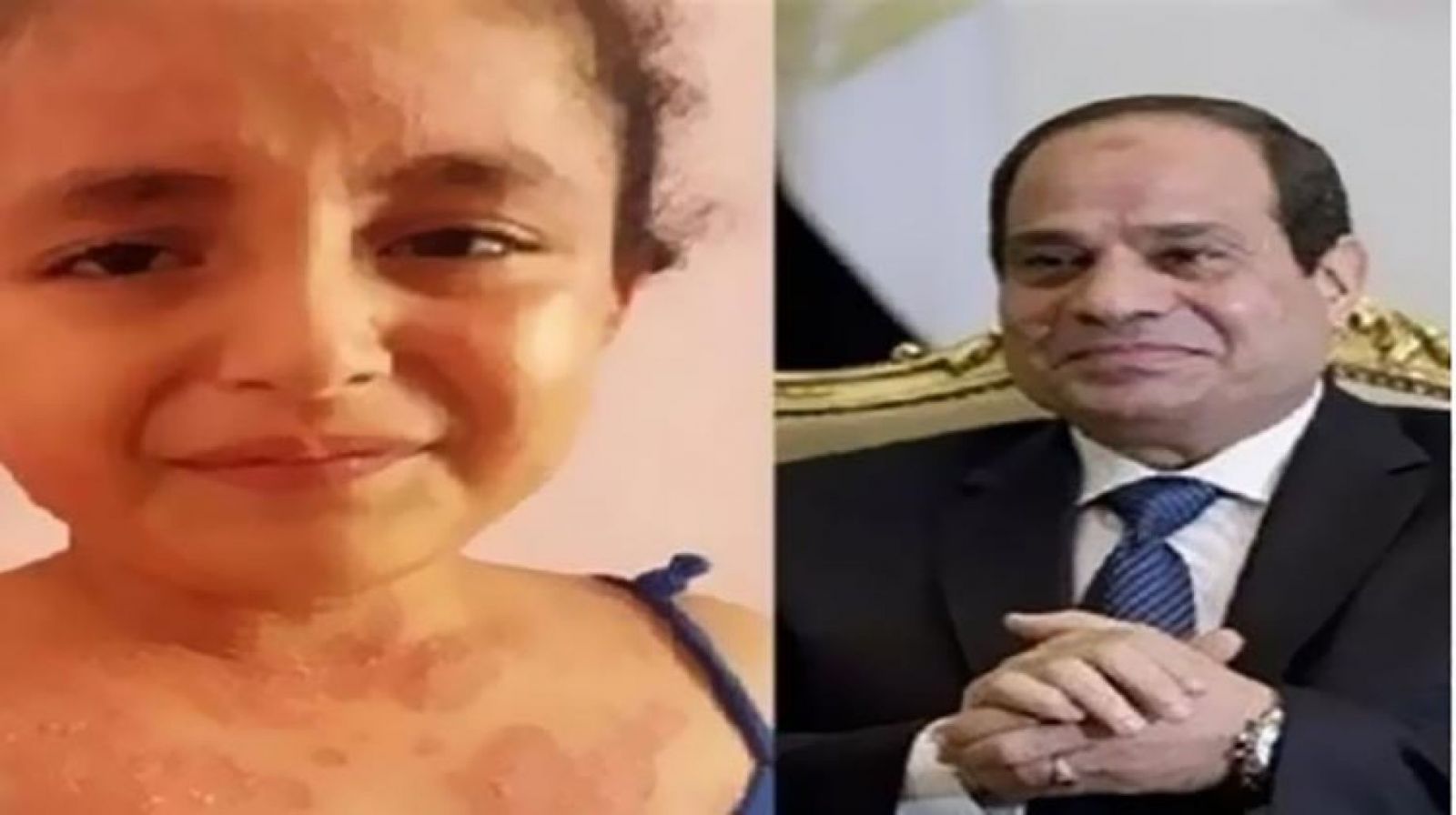 استجابة الرئيس السيسي لمناشدة أب فلسطيني يريد علاج أبنته