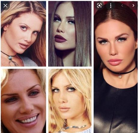 نيكول سابا قبل وبعد عمليات التجميل 