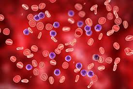 أنواع سرطان الدم 