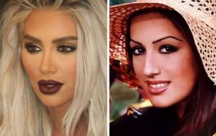 مايا دياب قبل وبعد عمليات التجميل